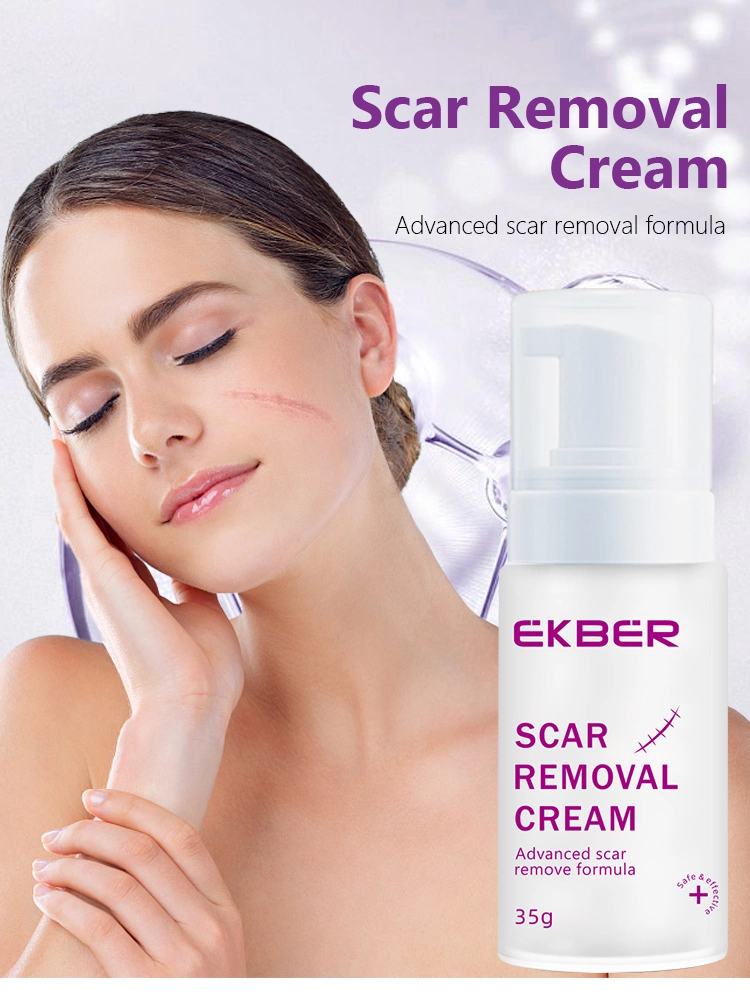 OEM Bulk Pure Natural Facial Effective Scar Removal Cream Anti Acne Skin Care